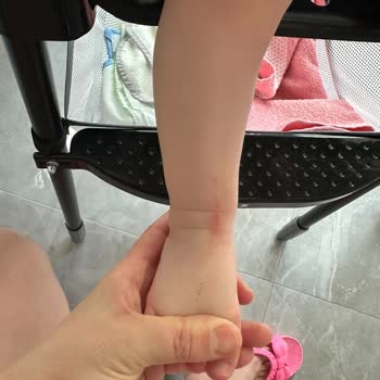 Tehlikeli Enjeksiyon Kalıntısı Bebek Ayağını Kesti Mama Sandalyesi Ücretsiz İade Ve Telafi Talebi