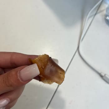 Sağlık Riski: Açık Kapaklar Ve Pestilde Saç Parçası