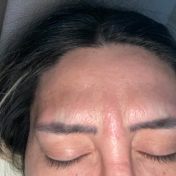 Esteluvia Estetik Mağduriyet Yaşama