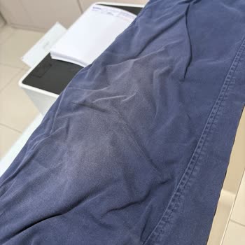 Kısa Sürede Renk Solması Ve Cep Sökülmesi Nedeniyle İade Ve Değişim Talebi