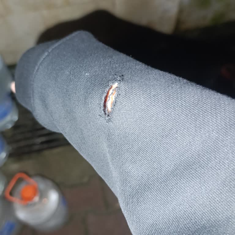 Pretend Hoodie Kolunda Aniden Yırtılma Ve Kalite Şikayeti