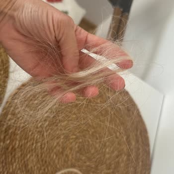 Eriz Ziylan Mikro Kaynak Sonrası Saç Dökülmesi Ve Soğuk Müşteri Yaklaşımı