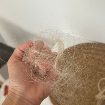 Eriz Ziylan Mikro Kaynak Sonrası Saç Dökülmesi Ve Soğuk Müşteri Yaklaşımı