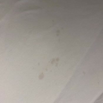 Athena Otel’de Hijyen Ve Hizmet Sorunları Nedeniyle Ücret İadesi Talebi