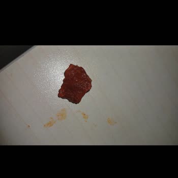Doritos Cipsinde Sert Cisim Dişimi Yaraladı
