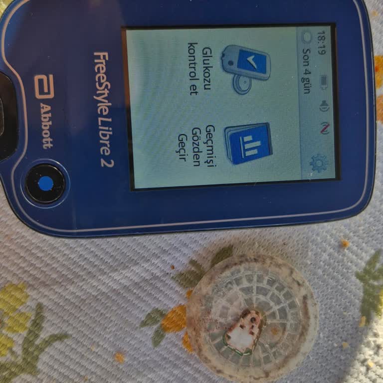 Abbott Freestyle Libre Sensörlerinde Erken Düşme Ve Ölçüm Hataları
