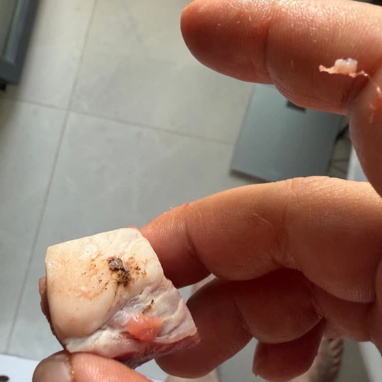 Migros Etinde Hayvan Tüyü Keşfi Ve Müşteri Şikayetine Yanıt Yok