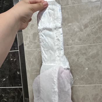 Kotex Yırtık Pedler Hijyen Riski Ve Mağduriyet