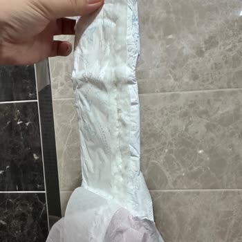 Kotex Yırtık Pedler Hijyen Riski Ve Mağduriyet