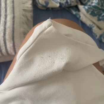 Kısa Sürede Tüylenen Bodysuit İçin Değişim Ve İade Talebi