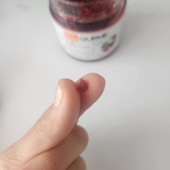 Pols Gurme Reçelde Kırık Kabuk Parçaları Diş Eti Yaraladı Ve Sağlık Riski
