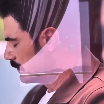 Mavi Lekelerle Mücadele: Samsung S90 OLED Televizyonun Garanti Değişim İsteği