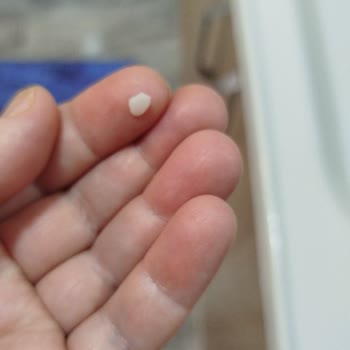 Kaplamam Kırıldı, 5 Aylık Yanıtsızlık Ve Garanti Talebi