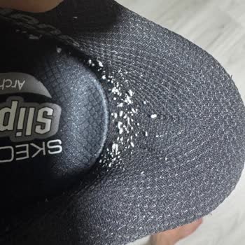 Skechers Ayakkabısı Üç Kullanımda Deforme Oldu, Gerekçesiz Reddedildi