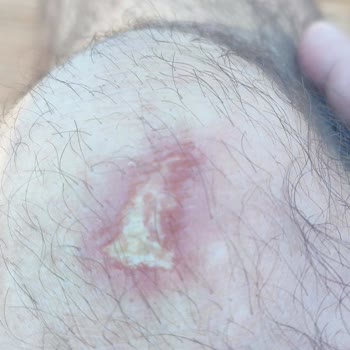 Shell Kartepe İstasyonunda Uyarı Levhası Eksikliği Nedeniyle Kaygan Zeminde Düşme Ve Yaralanma