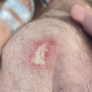 Shell Kartepe İstasyonunda Uyarı Levhası Eksikliği Nedeniyle Kaygan Zeminde Düşme Ve Yaralanma