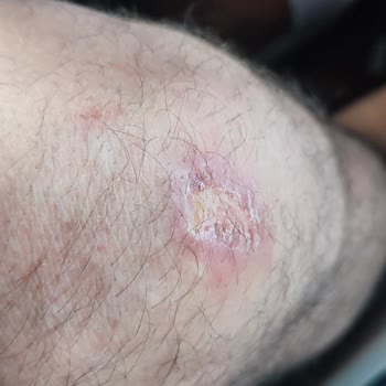 Shell Kartepe İstasyonunda Uyarı Levhası Eksikliği Nedeniyle Kaygan Zeminde Düşme Ve Yaralanma