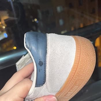 Adidas Ayakkabısında Kalıcı Boya Lekeleri Ve Deri Aşınması