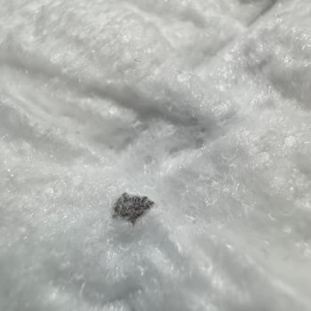 Molfix Bezinde Sert Yabancı Madde Çıktı: Bebek Sağlığı Tehlikede