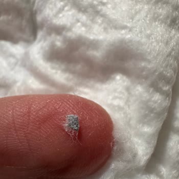 Molfix Bezinde Sert Yabancı Madde Çıktı: Bebek Sağlığı Tehlikede