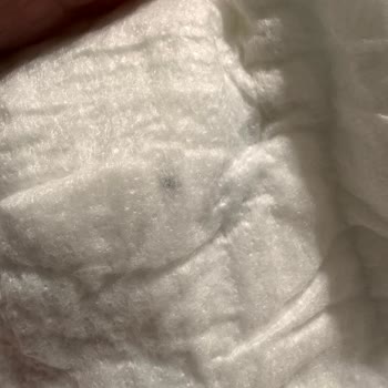 Molfix Bezinde Sert Yabancı Madde Çıktı: Bebek Sağlığı Tehlikede