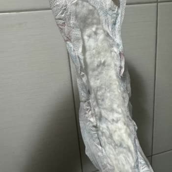 Kotex Ultra Gece Ürünlerinde Bozulmuş Paketler Ve Cilt Yanması