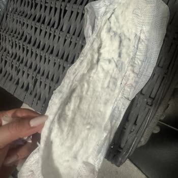 Kotex Ultra Gece Ürünlerinde Bozulmuş Paketler Ve Cilt Yanması