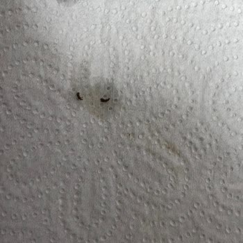 Yayla Gıda Getir'den Satın Alınan Baldo Pirinçte Böcek Bulunması