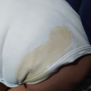 Sleepy Bebek Bezinde Sürekli Sızıntı Ve Kalite Düşüşü