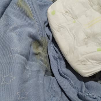 Sleepy Bebek Bezinde Sürekli Sızıntı Ve Kalite Düşüşü