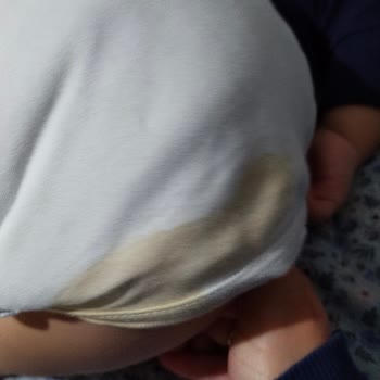 Sleepy Bebek Bezinde Sürekli Sızıntı Ve Kalite Düşüşü