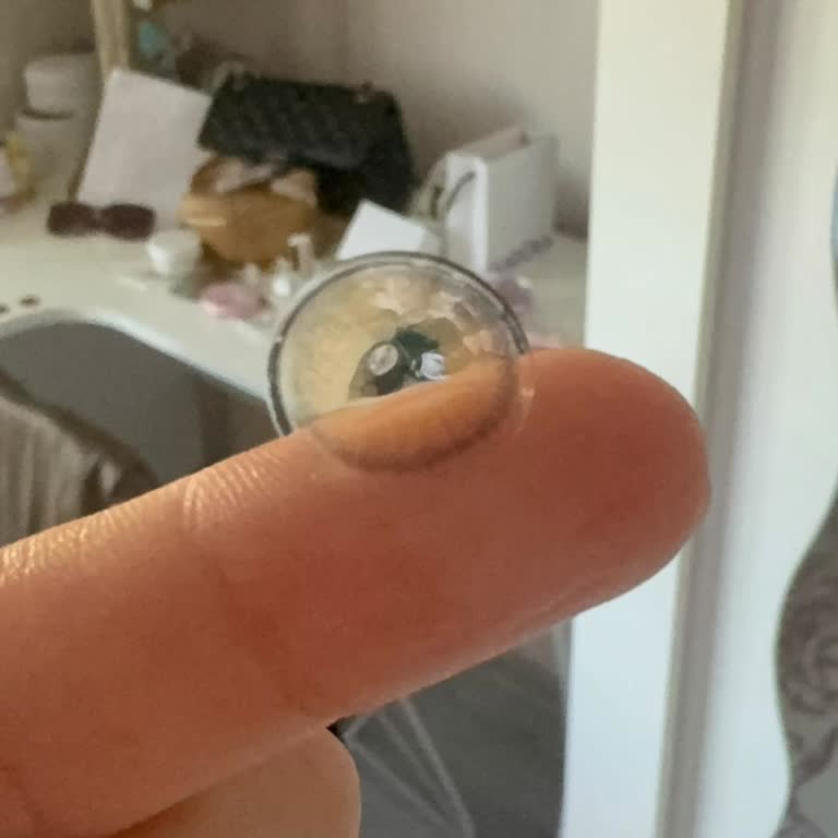 İconic Lenslerde Şekil Bozukluğu Ve Yetersiz Satış Sonrası Destek