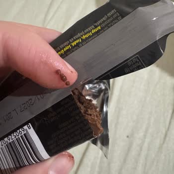 Eti Browni Intense İçindeki Taş Nedeniyle Diş Ve Ağız Yaralanması