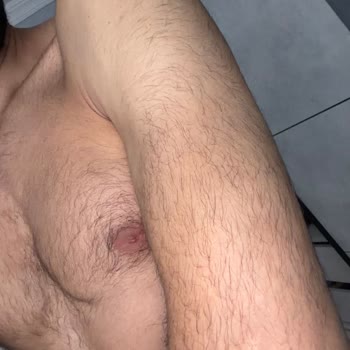Lazer Epilasyon Sonrası Kıllar Kalınlaştı Ve Yeni Kıllanma Oluştu