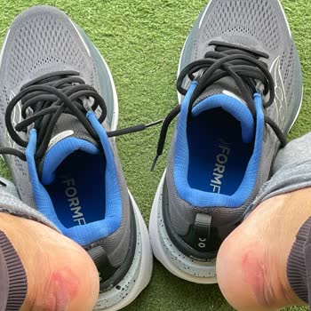 Saucony Hurricane 25 Ayakkabısının Sert Arka Bölümü Nedeniyle Ayak Şişmesi Ve Değişim Şikayeti