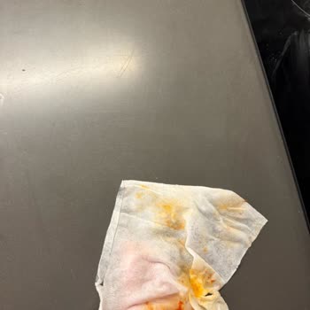 Bebek Hassas Cildine Uygun Mendilde Sert Plastik Parça Çıktı
