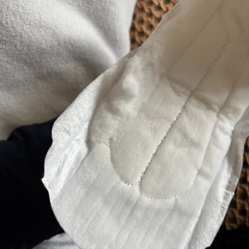 Molped Pure Soft Pedlerinde Yırtık Ve Pamuk Dökülmesi: Kalite Ve Hijyen Sorunu