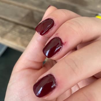 Asya Nail Art & Beauty İşlem Sonrasında Yoğun Ağrı, Hassasiyet ve Kızarıklık Oluştu