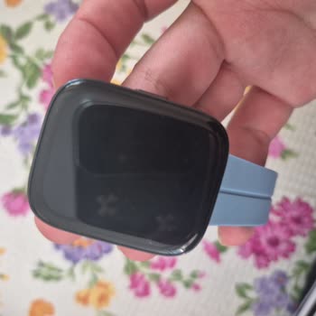 Xiaomi Redmi Watch 3 Active Şarj Sorunu Ve Getmobil Garanti Talebi Hatası