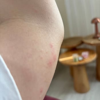 Tahtakurulu Oda Hijyeni Misafirleri Sağlık Riskiyle Yüz Yüze Bıraktı