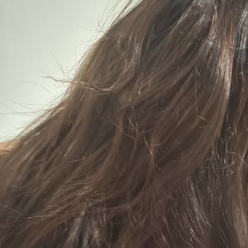 Bioxcin Şampuanı Saç Dökülmesi Ve Kırılmalara Neden Oldu, Geri Dönüş Yok