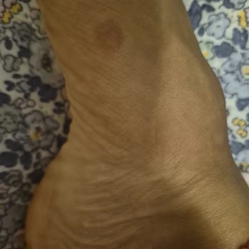 Cihan Ayakkabıda Taşlı Terlikten Ayağım Yara Oldu, Fatura Almadım Ve Müşteri Hizmetleri Soğuk