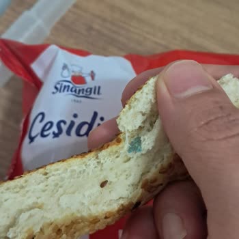 Sinangil Donuk Simitinde Taş Benzeri Yabancı Madde Ve Sağlık Riski