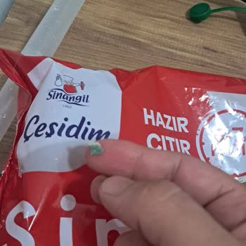 Sinangil Donuk Simitinde Taş Benzeri Yabancı Madde Ve Sağlık Riski