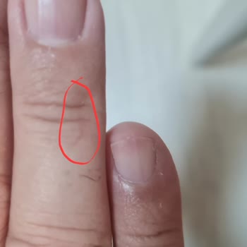 Arçelik Fırının Sağ Raf Aparatı Tehlikeli Tasarım Ve Yanıklara Sebep Oluyor