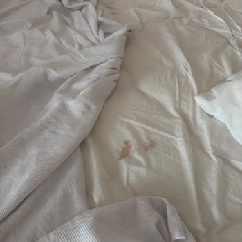 Jakuzili Oda Hijyen Sorunu Ve Oda Değişikliği Reddedilmesi Nedeniyle Erken Çıkış