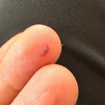 Bebek Arabası Takma Mekanizması Zor Kullanım Ve Güvenlik Sorunu