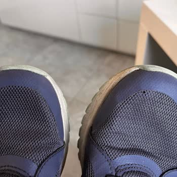 Az Kullanılmış Skechers Arch Fit Ayakkabısının Başparmak Kısmı Yırtıldı Ve Değişim Reddi