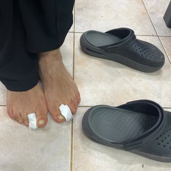 Crocs Literide Terlikte Ayak Ağrısı Ve Mantar Şikayeti