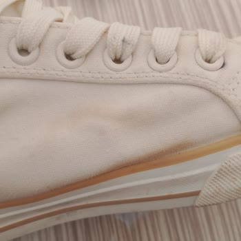 Kadın Sneaker’da Kısa Sürede Sarı Lekeler